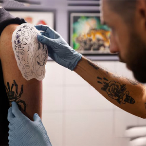 Everything You Need to Know Before Choosing Your Tattoo Removal Method